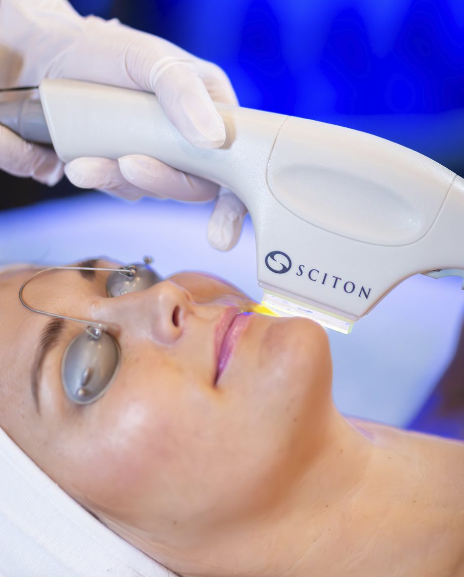 IPL (PHOTOFACIAL) + SKIN TIGHT COMBO