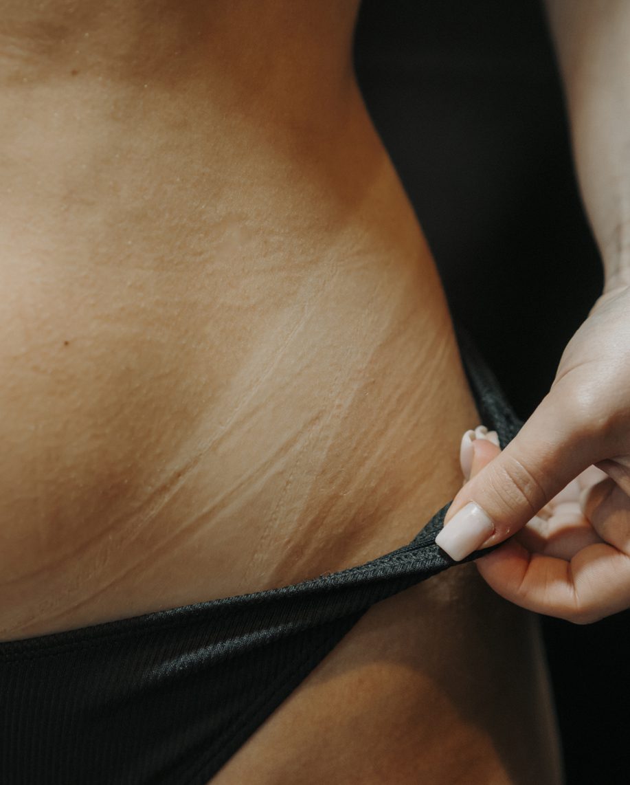 Sunless Tanning