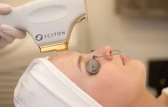 Facial Rejuvenation at Gentle Touch Spa & Laser - Bedford, Dartmouth and Halifax